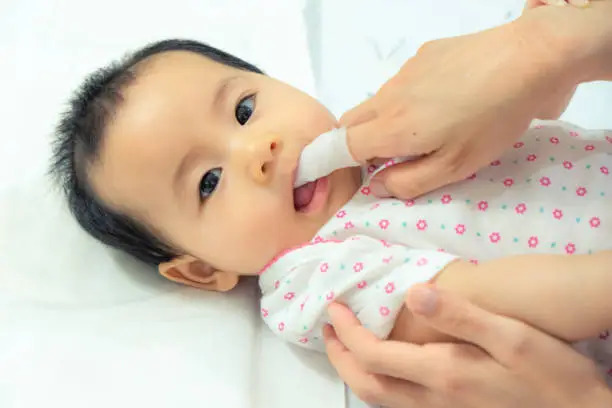 How to Treat Tongue Tie in Infants?