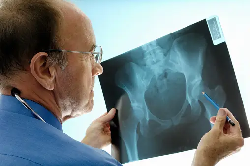 How does one diagnose osteoporosis?