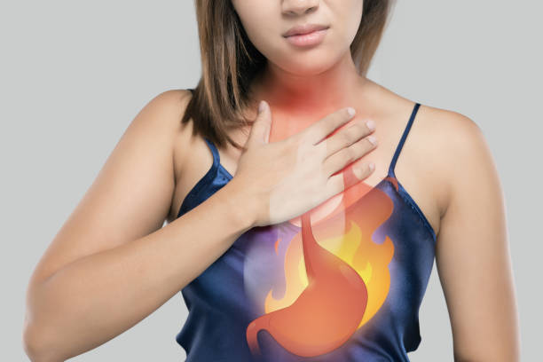 Types of Gastroesophageal Reflux Disease