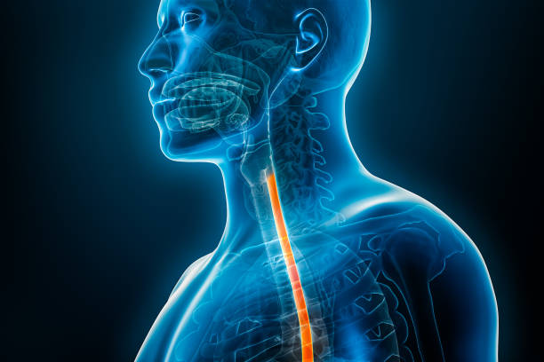 Types of Esophagitis