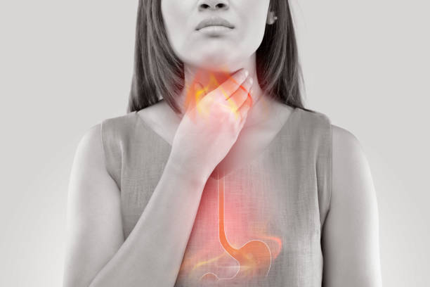 Causes of Gastroesophageal Reflux Disease