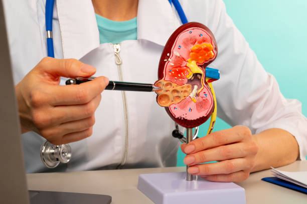 Causes of Kidney Disease