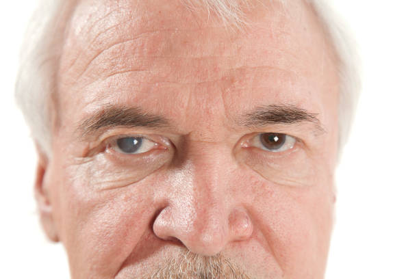 Symptoms of Cataracts