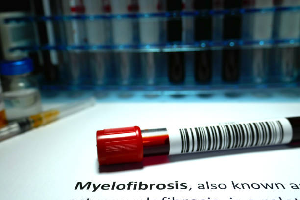 Types of Myelofibrosis