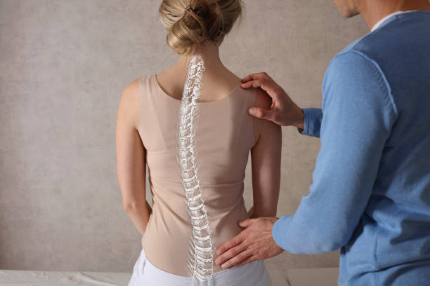 Types of Scoliosis